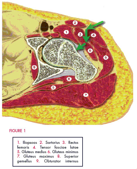 Muscle cross section
